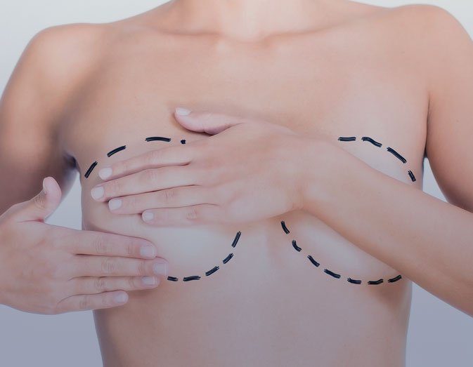 Breast lipofilling