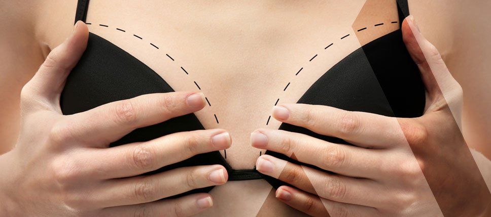 breast-augmentation-turkey-price