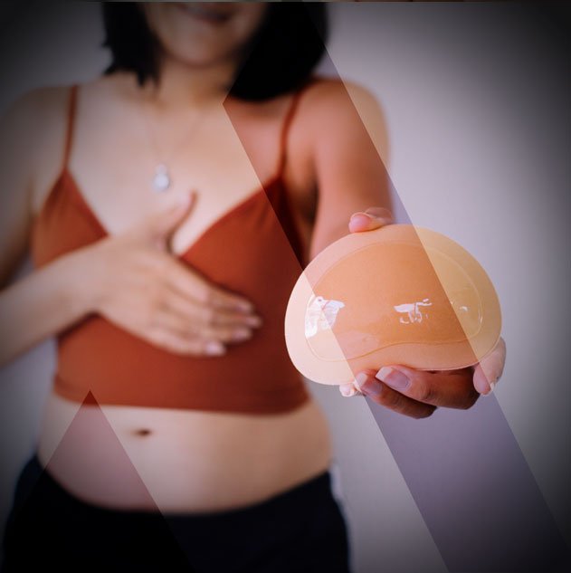 change-breast-prothesis